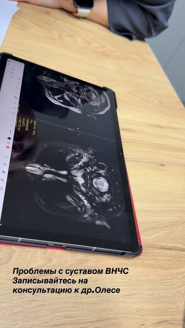 Реставрация зубов