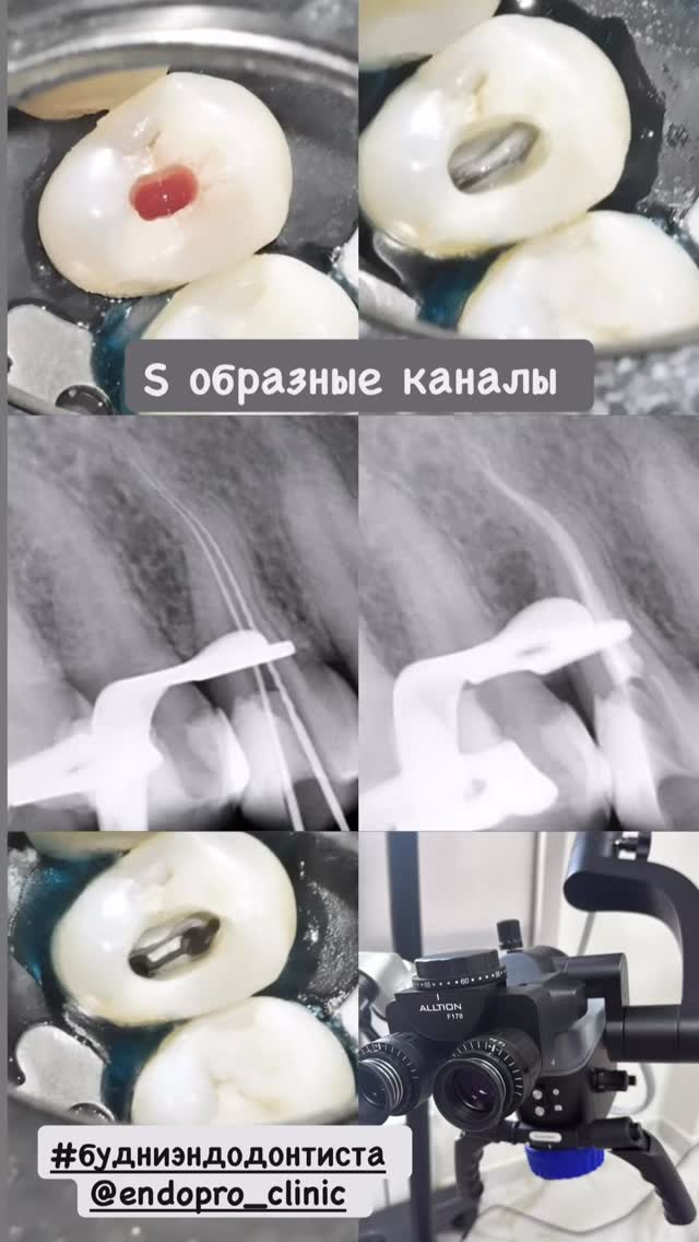 Лечение ВНЧС