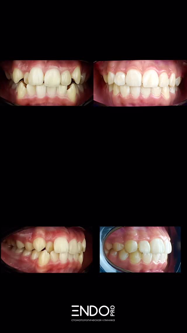 Профессиональная гигиена