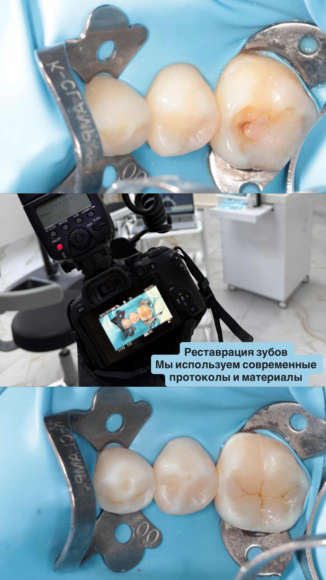 Детская стоматология