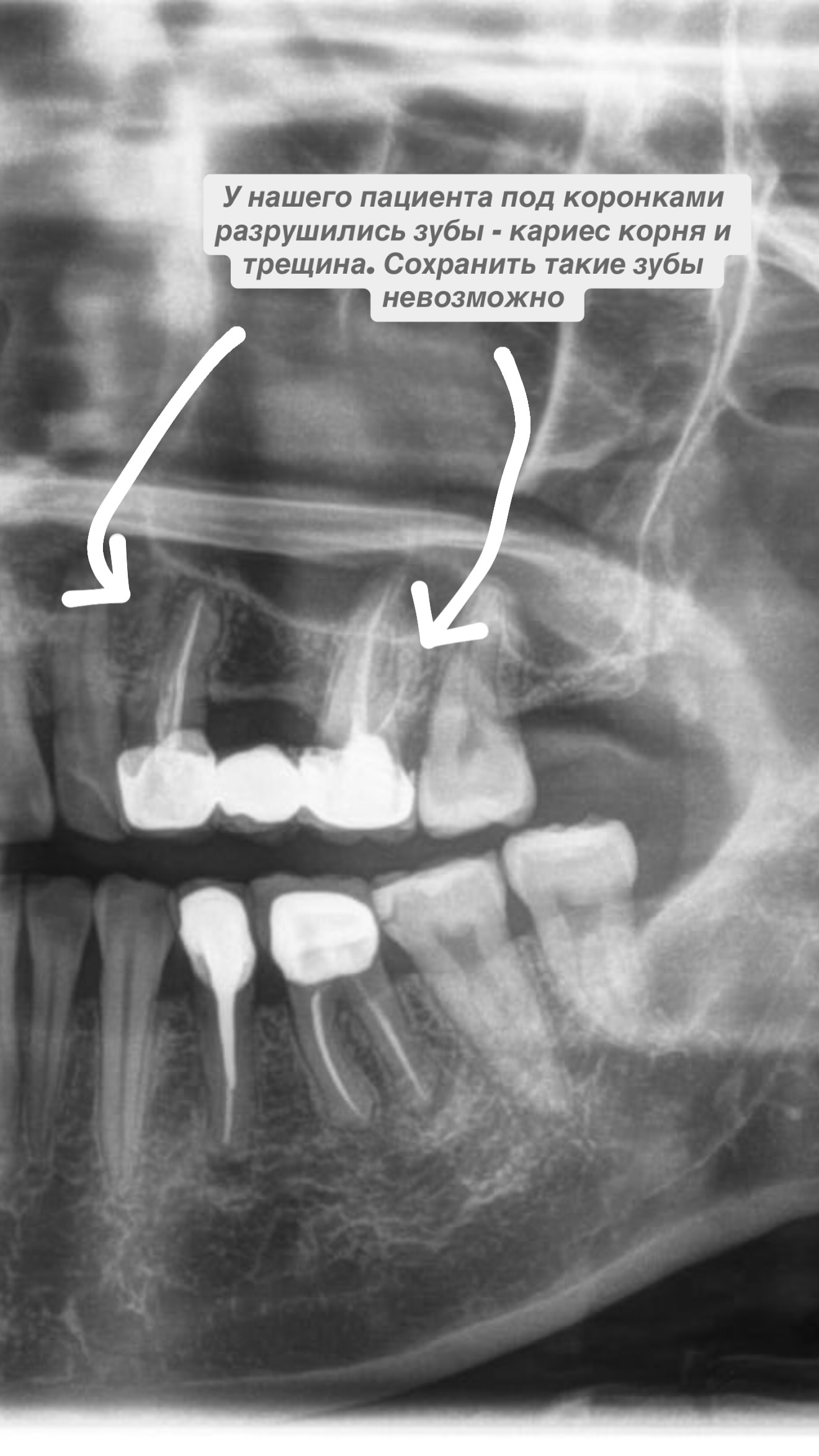 Результат лечения