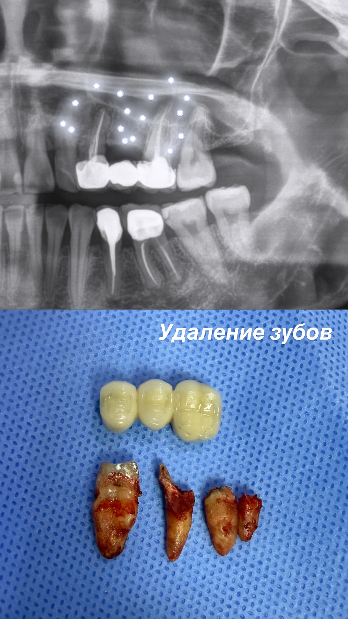 Результат лечения