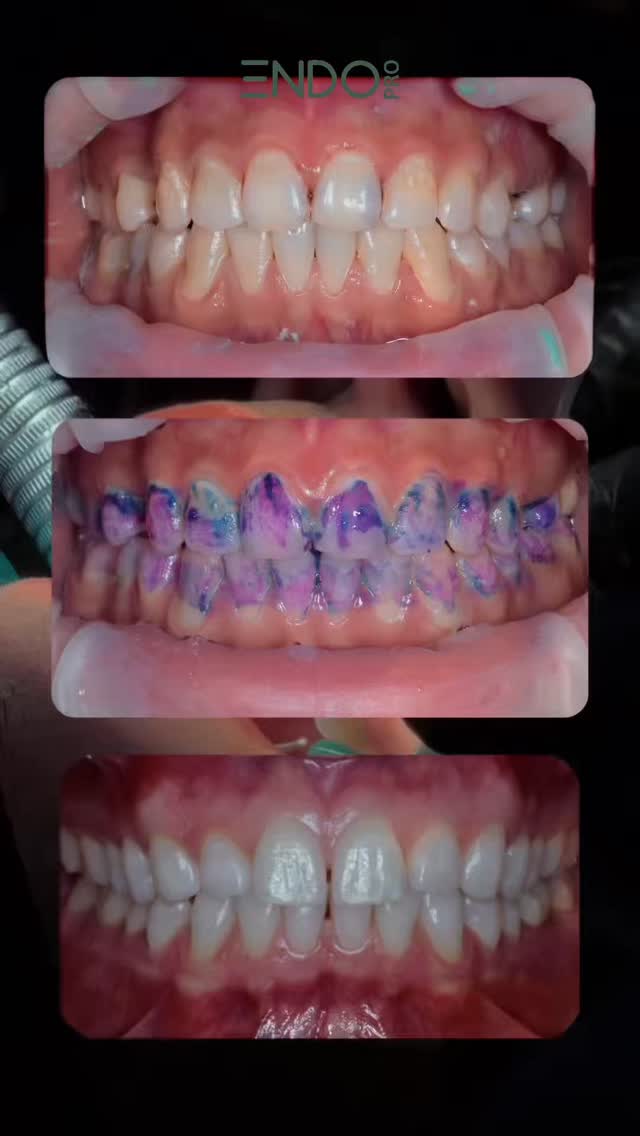 Путь к идеальной улыбке